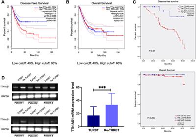 Targeting Long Non-Coding RNA TTN-AS1 Suppresses Bladder Cancer Progression